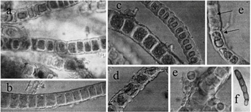 Fonalas talajalgák mikroszkópos képe (Forrás: SMITH et al., 2004)